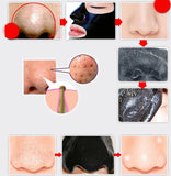 PILATEN Blackhead Remover Deep Cleansing Purifying Peel Black Suction Face Mask